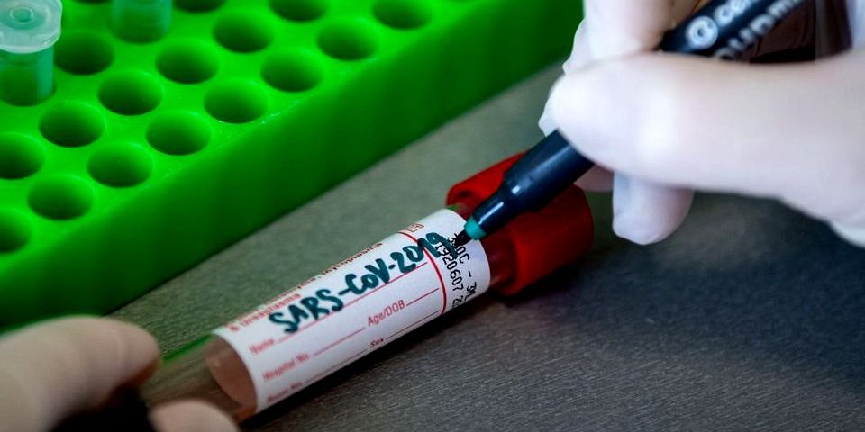 test-coronavirus-covid19-SERJMIN